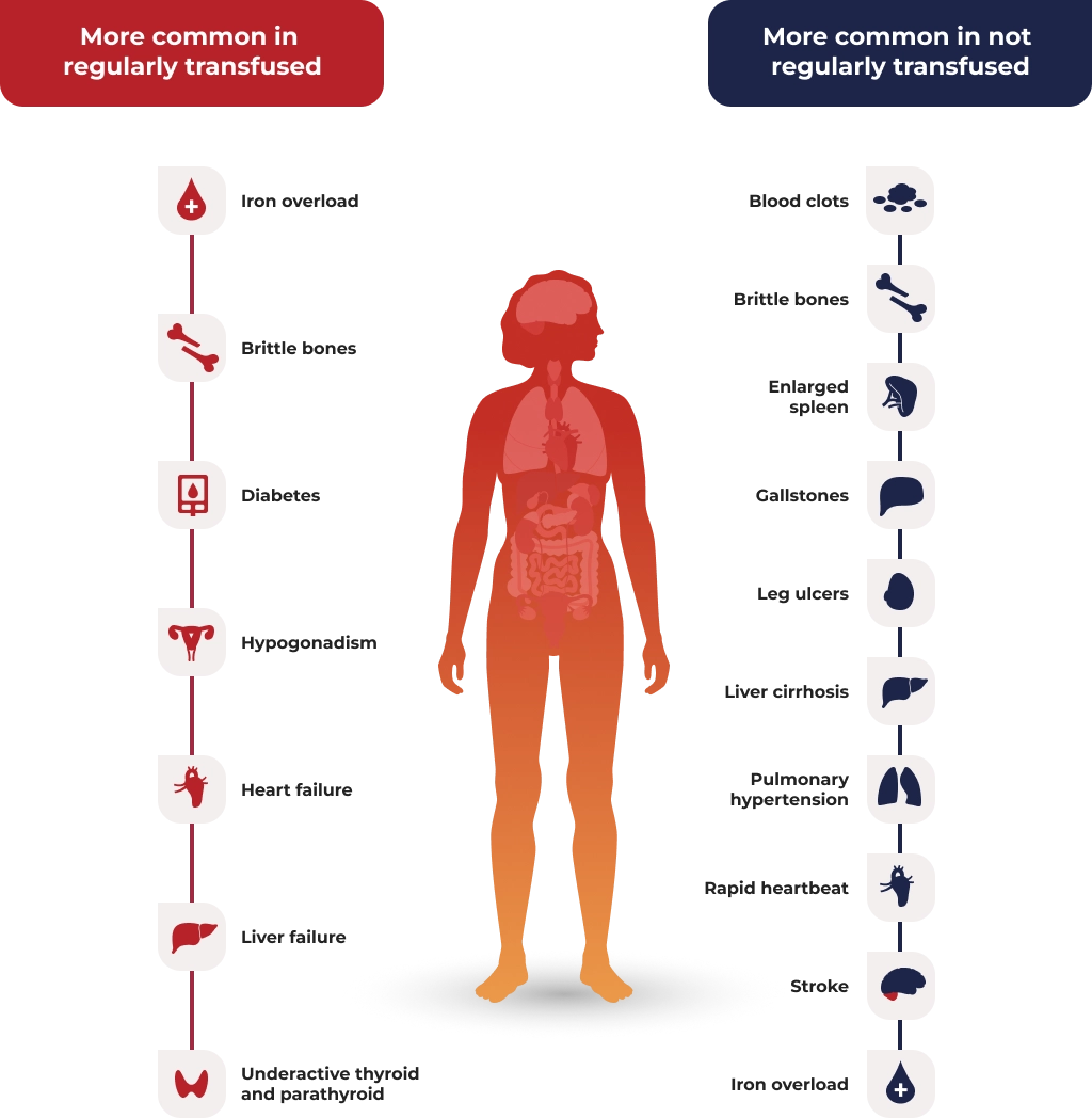 Patients with beta-thalassemia major experience different symptoms than those with beta-thalassemia intermedia or alpha-thalassemia.